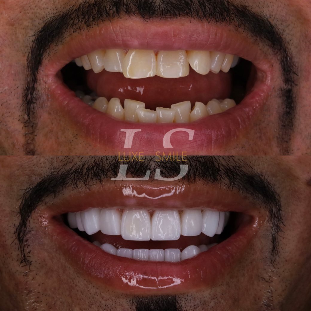 Transformation 07 — before and after
