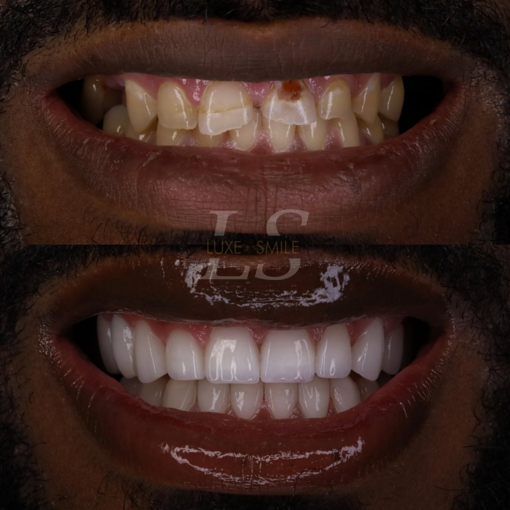 Transformation 05 — before and after